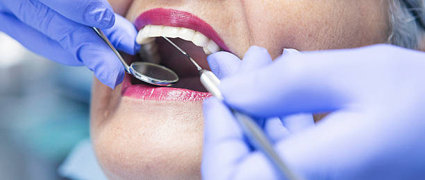 Best Emergency Tooth Extraction in Marlow, OK
